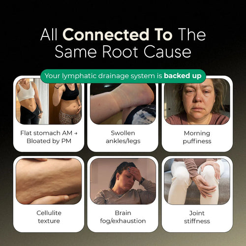 Lymphatic Drainage Capsules by Sculptique™